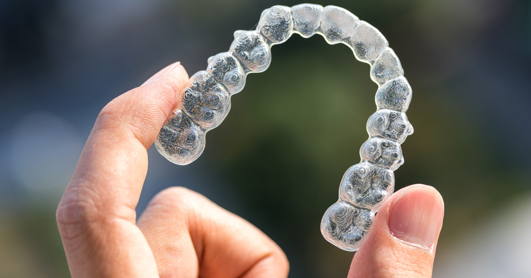 How Long Do Braces vs. Invisalign Take?