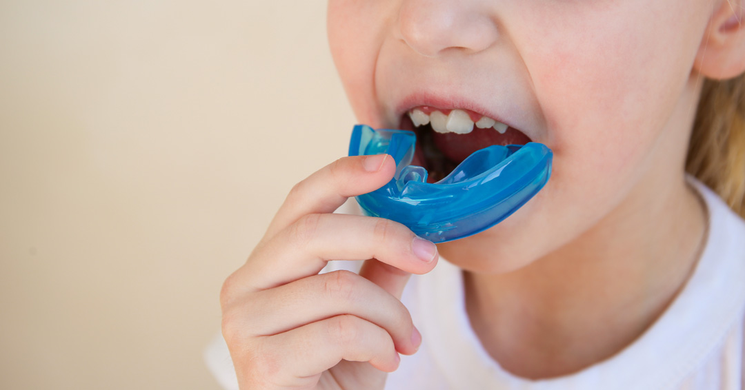 The Benefits of Early Orthodontic Screening for Children